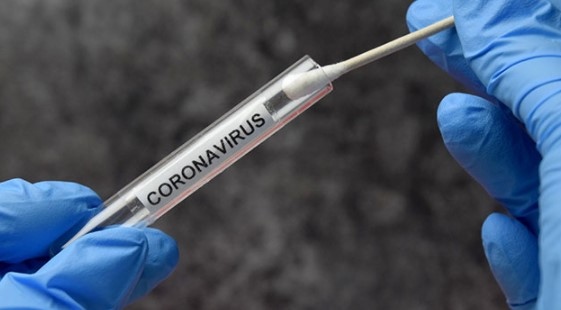 1959 нови заразени с COVID 19 отчитат здравните власти Направените изследвания